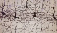 1990 – Foto de Neuronas – Santiago Ramón y Cajal